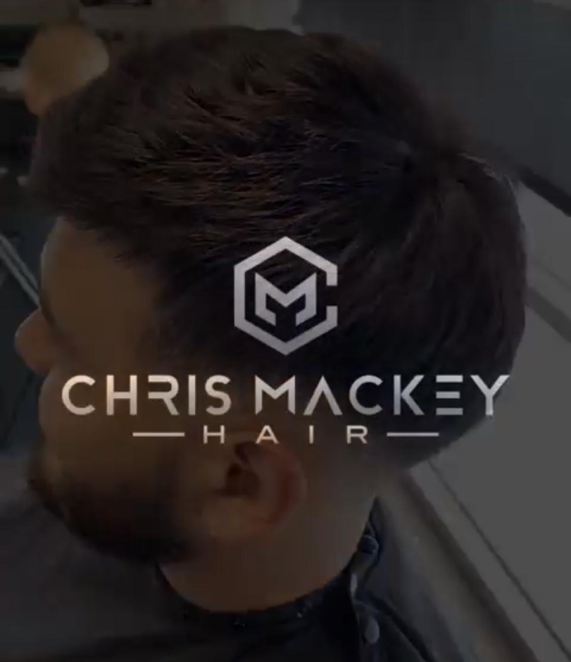 Hair Replacement Consultation