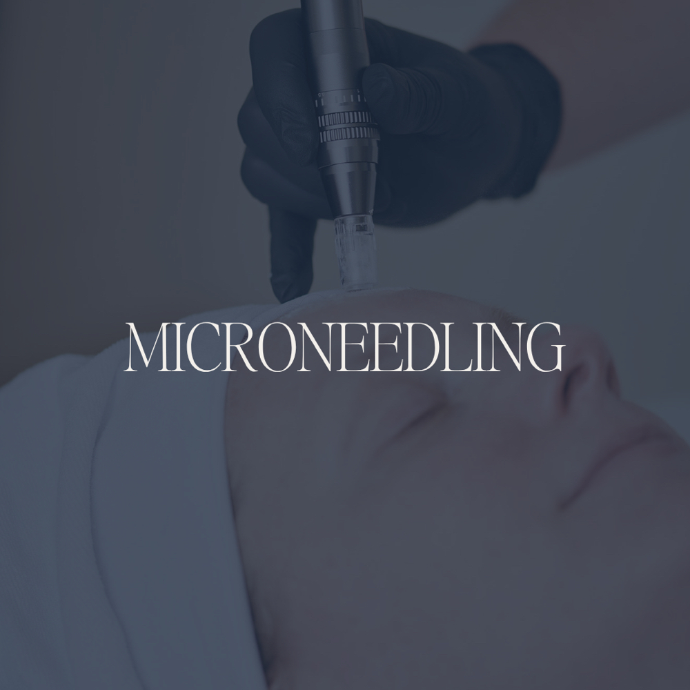 Microneedling at Skin With Christine in Las Vegas, NV