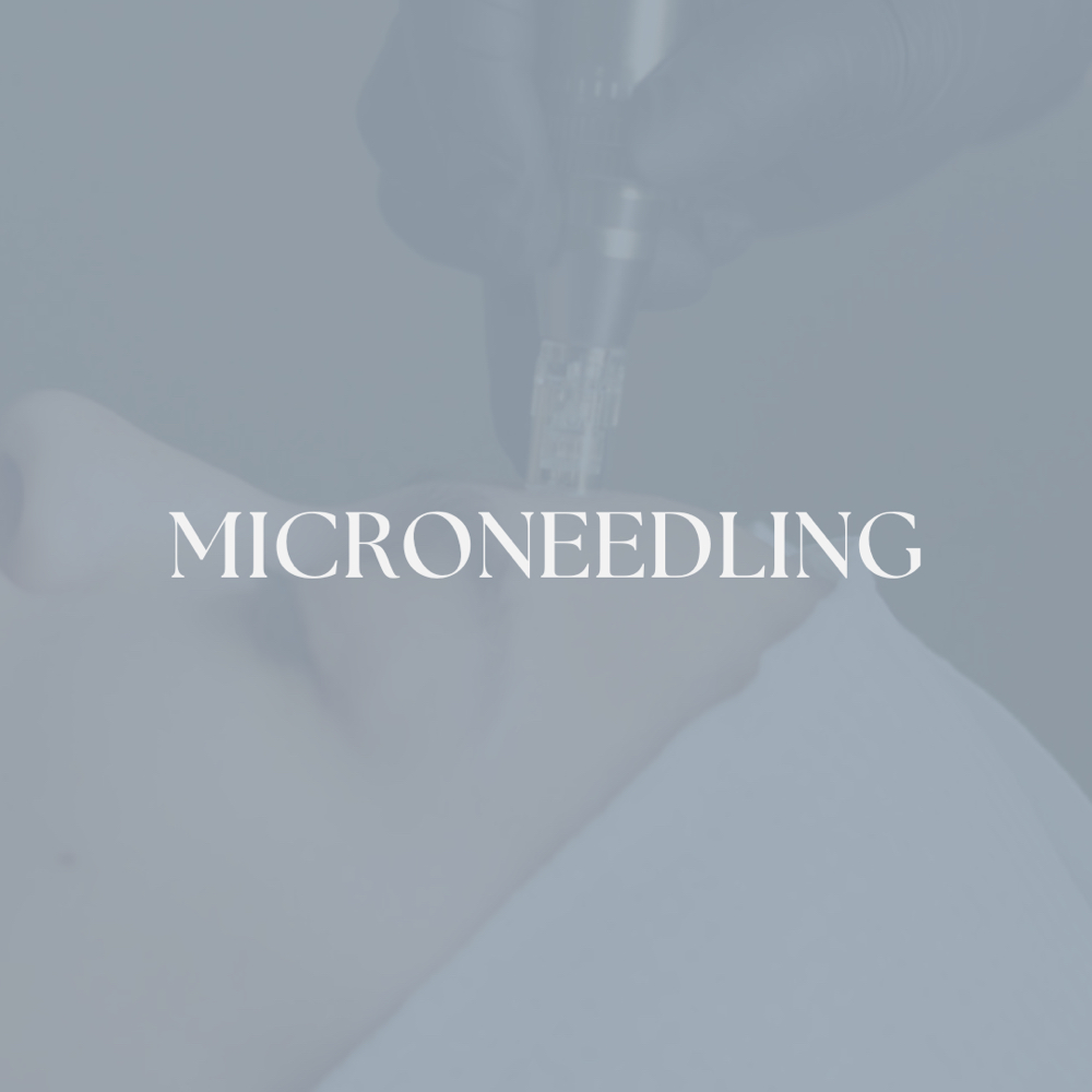 Microneedling at Skin With Christine in Las Vegas, NV