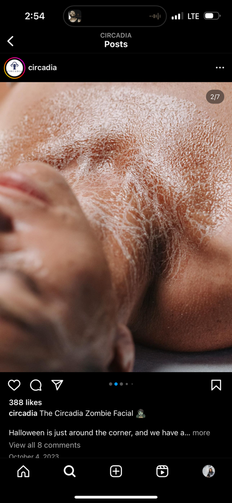 Beyond Botox -  Peptide Facial