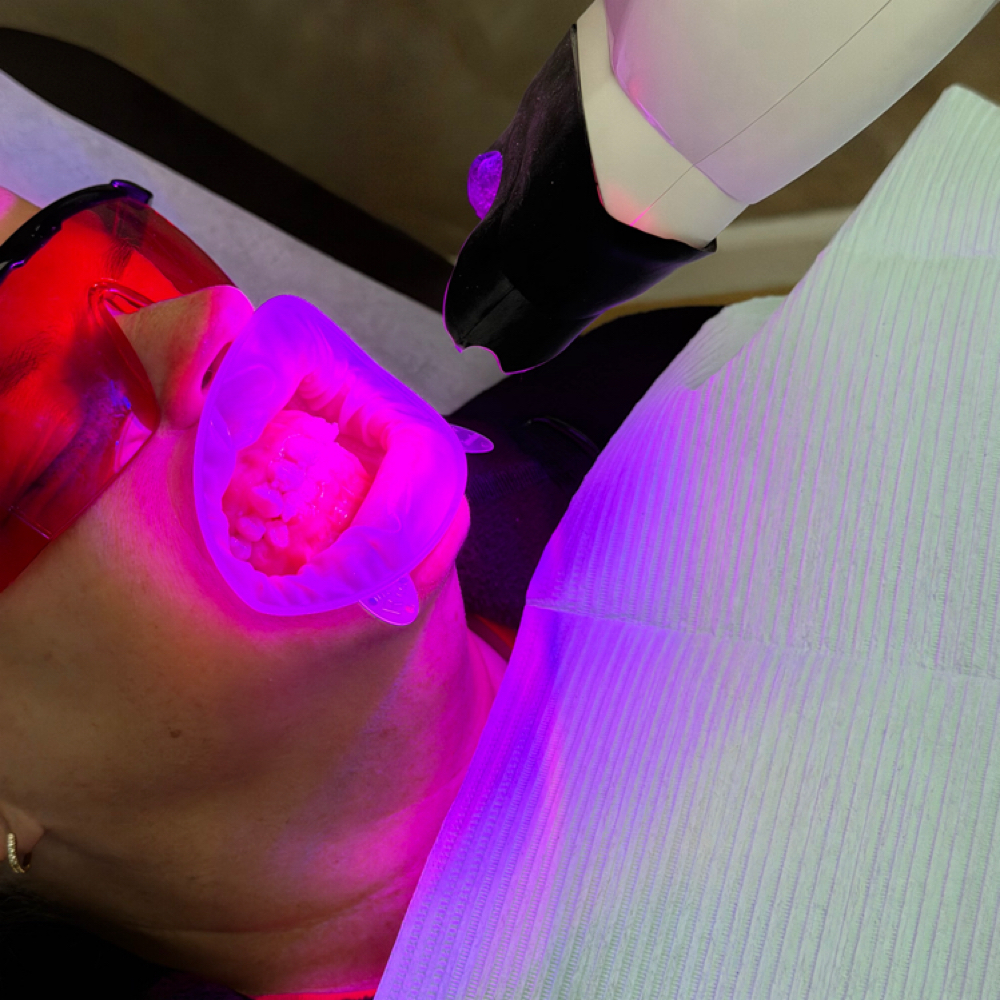 First Time Guest - Teeth Whitening at Bareology in Montclair, NJ