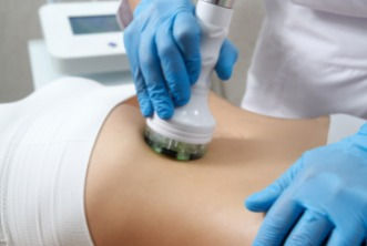 Skin Tightening RF