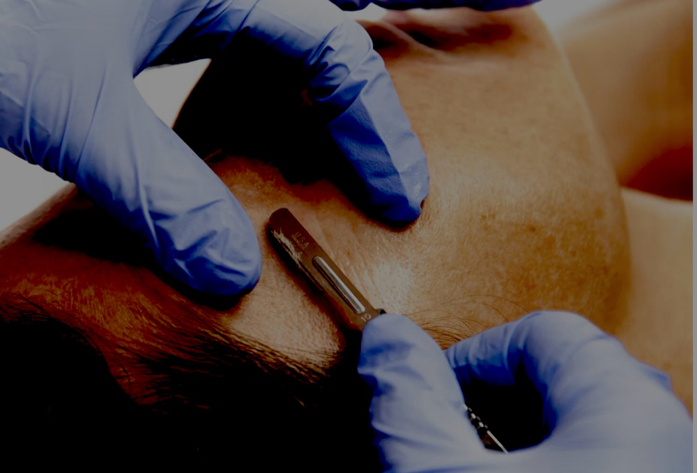 Express Dermaplaning Facial