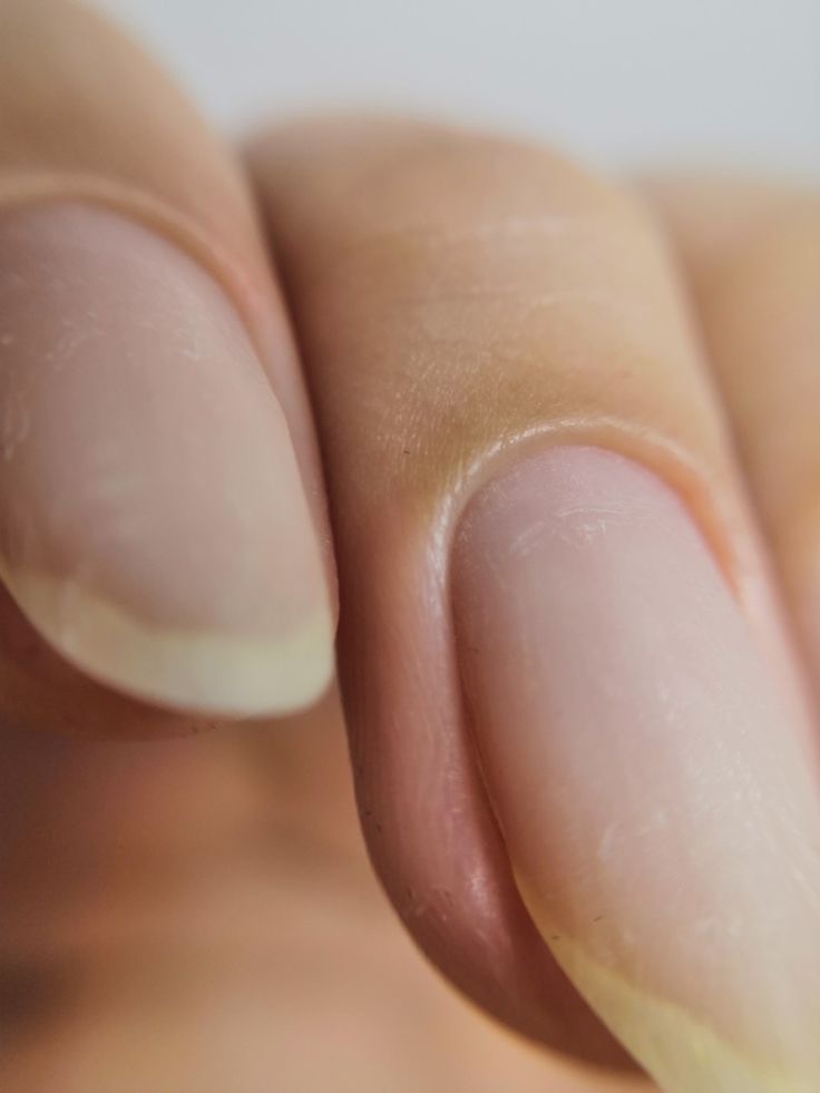 Nail Repair at nailsxneena in Oxnard, CA