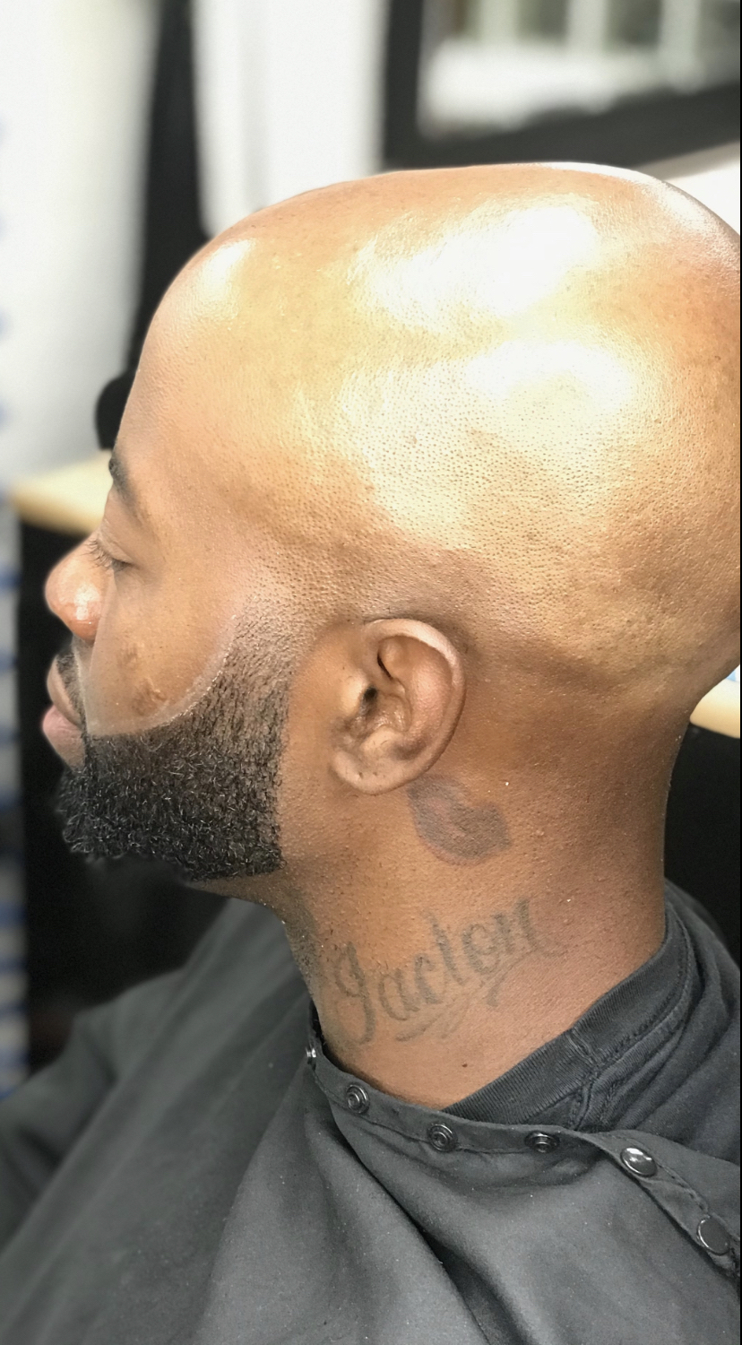 Bald Head + Face