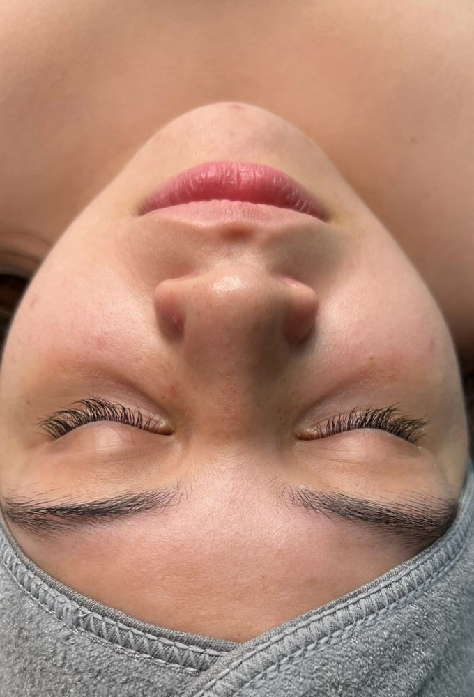 Dermaplane Facial
