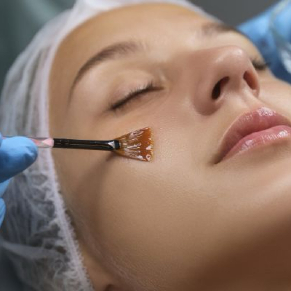 Chemical Peel Add On at Loba Beauty Spa in Paterson, NJ