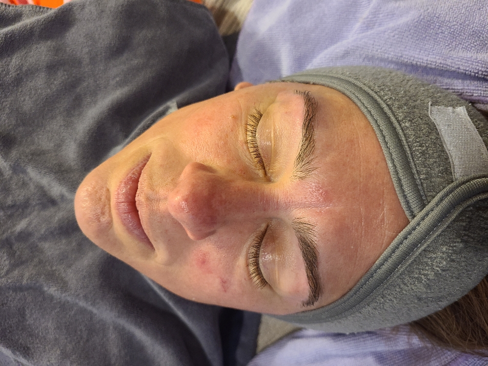 Sensitive Skin Facial