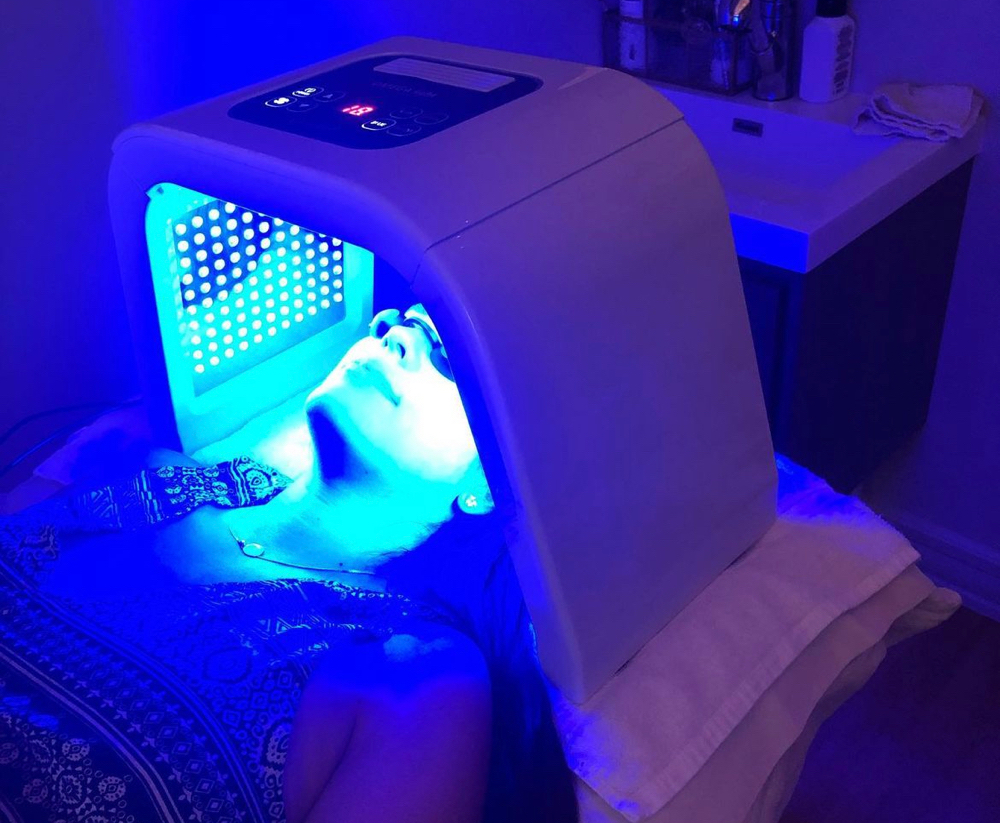 Acne Facial with BLUE Light