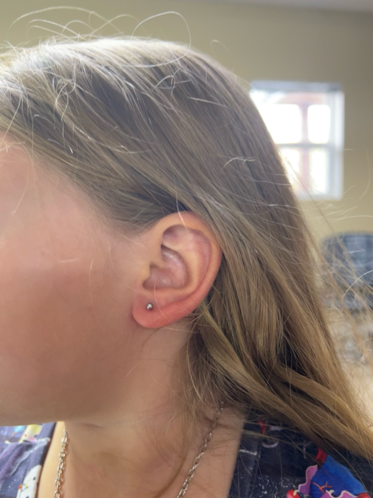 1 piercing (minor)