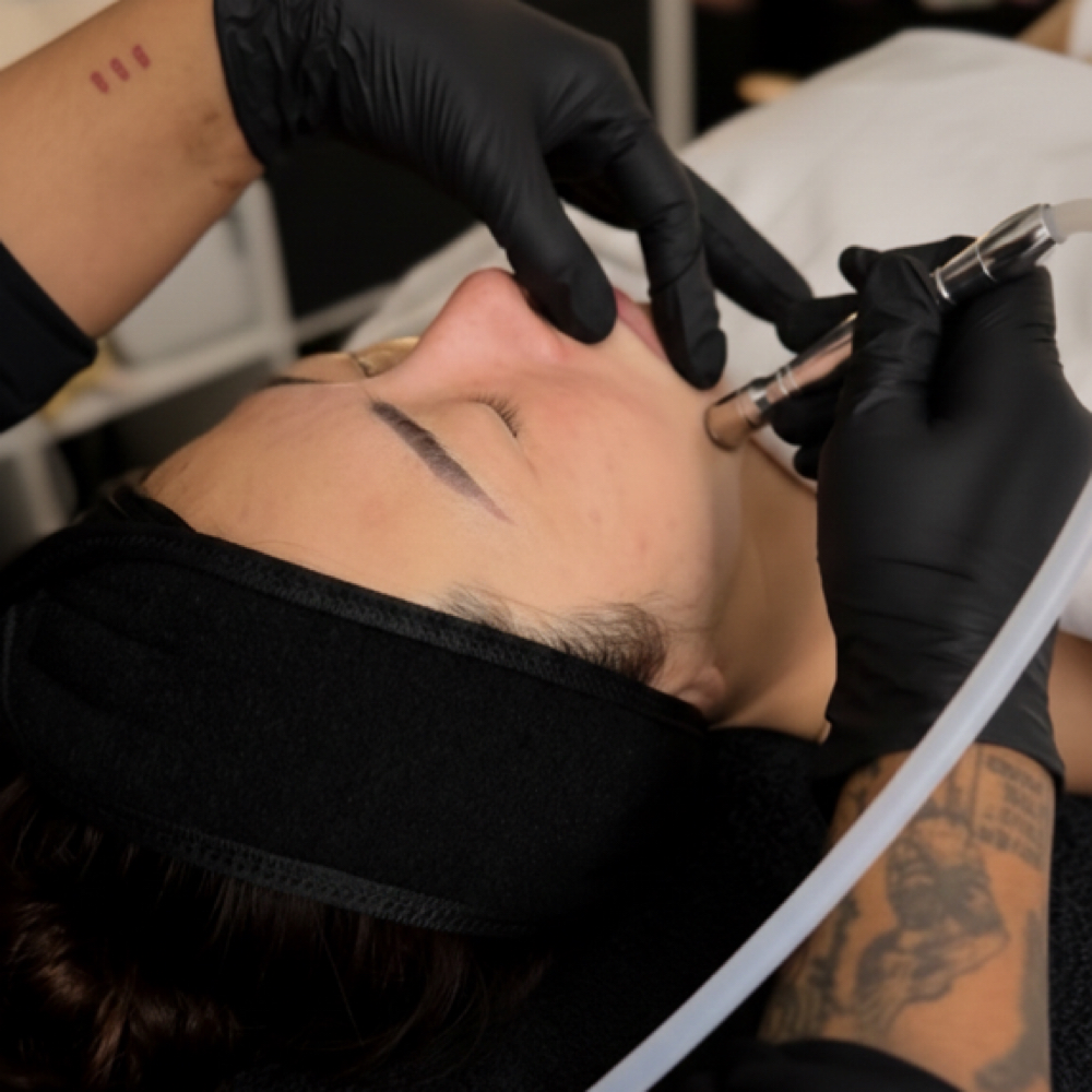 Microdermabrasion | Skin Polish at Fidelis Skin Theory in Las Vegas, NV