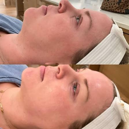 Her. Signature Glass Skin Facial.