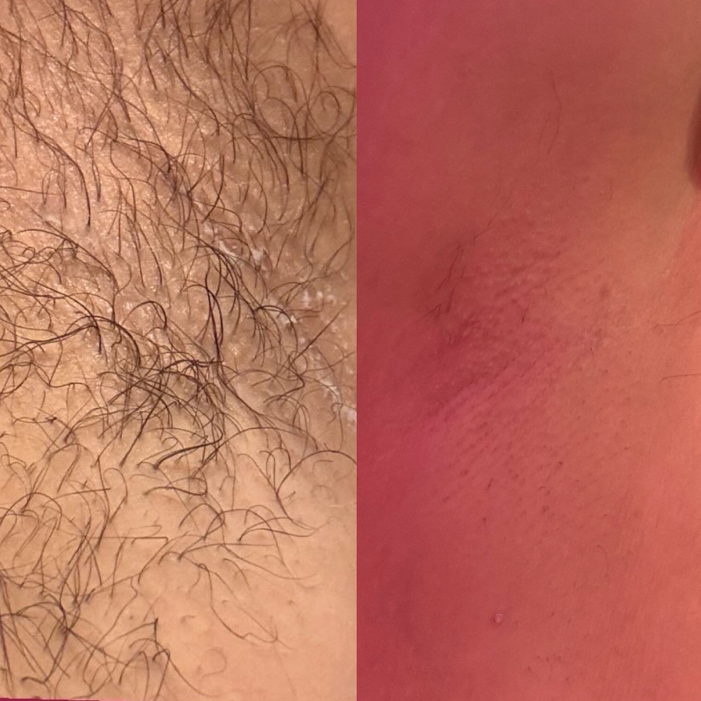 Underarm Wax Add On