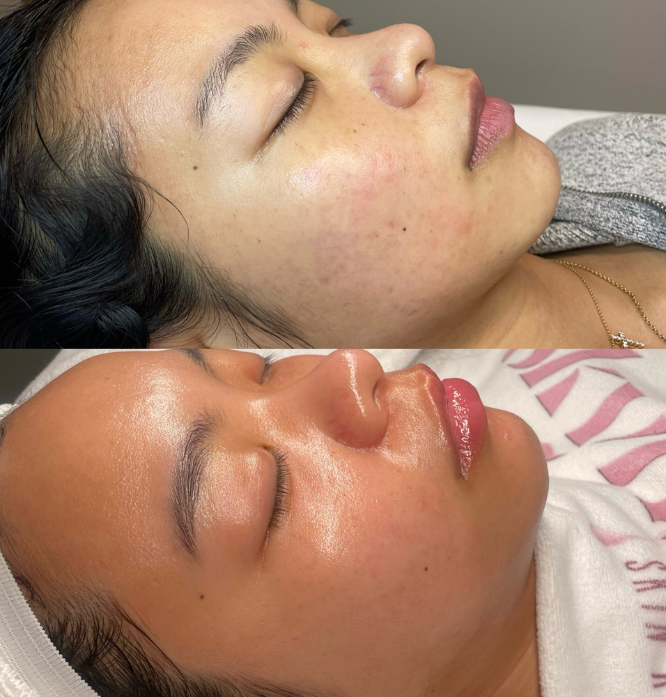 Glass Skyn Facial