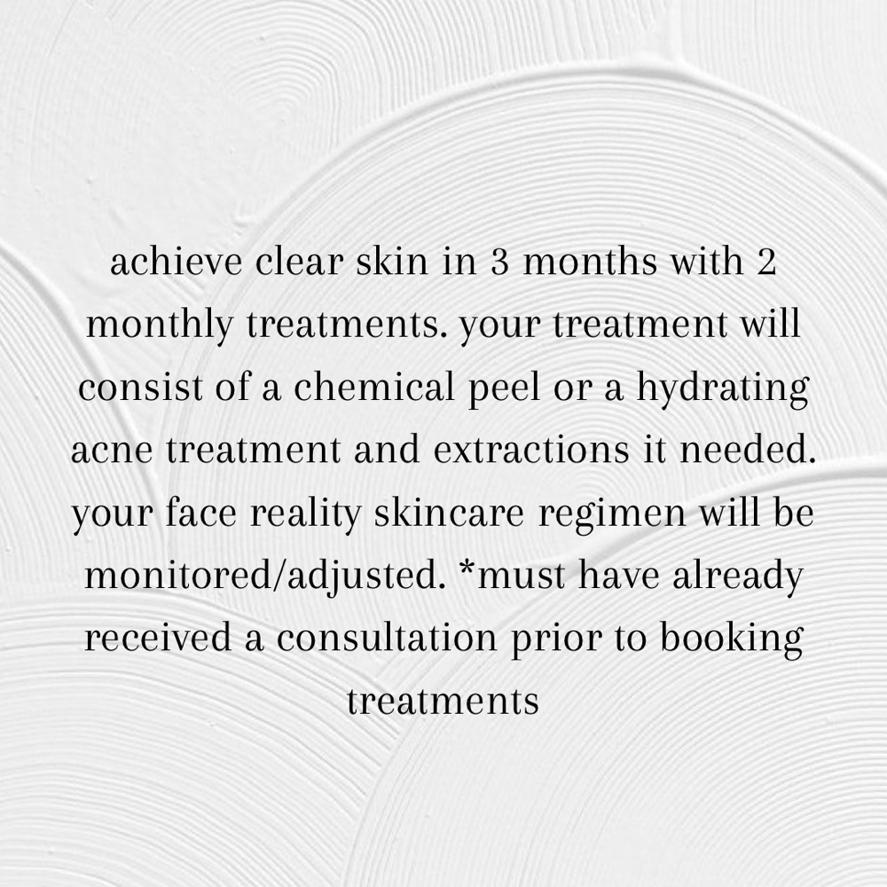 Acne Bootcamp Treatment