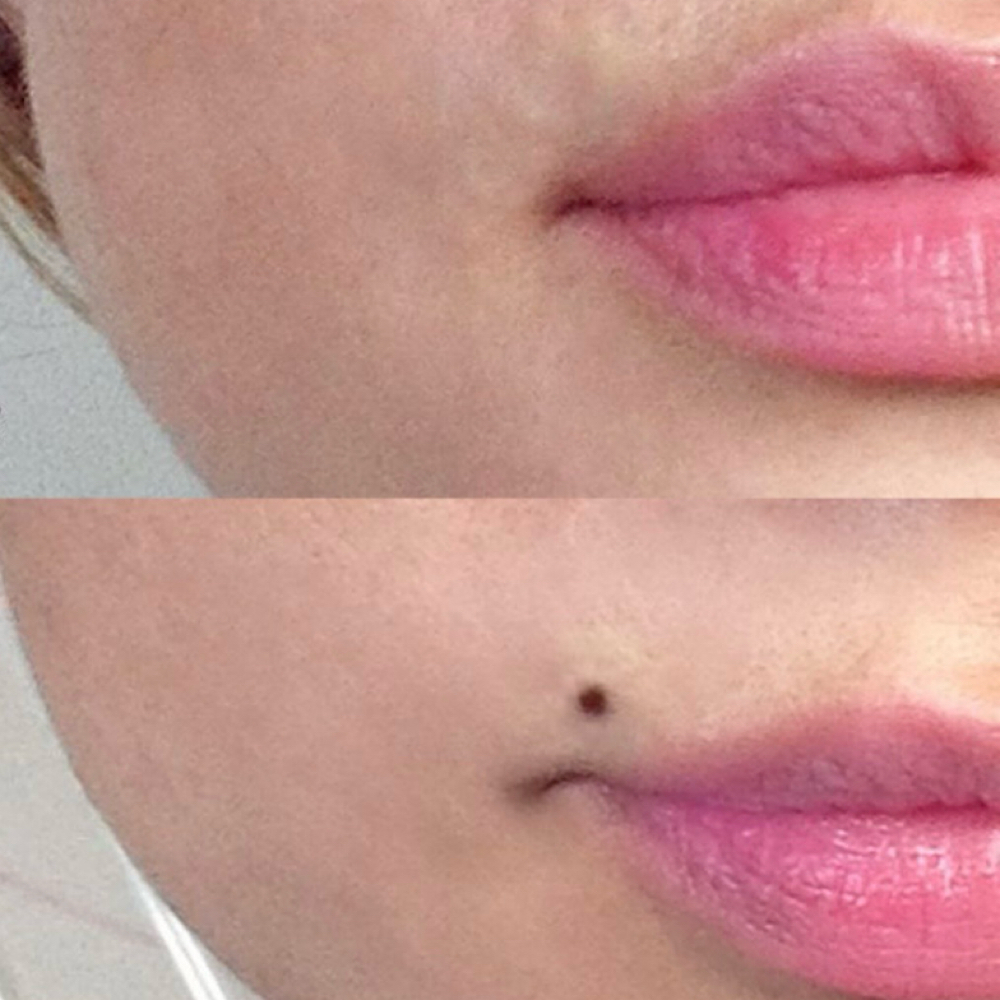 Signature Beauty Mark at Zen Spa Aesthetics in Torrance, CA