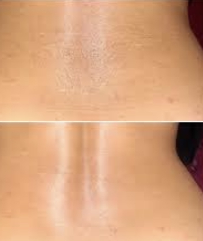 Lower Back Wax Women