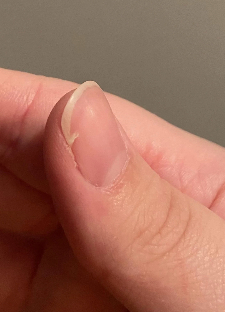 Add-On Simple Nail Repair 1 Nail