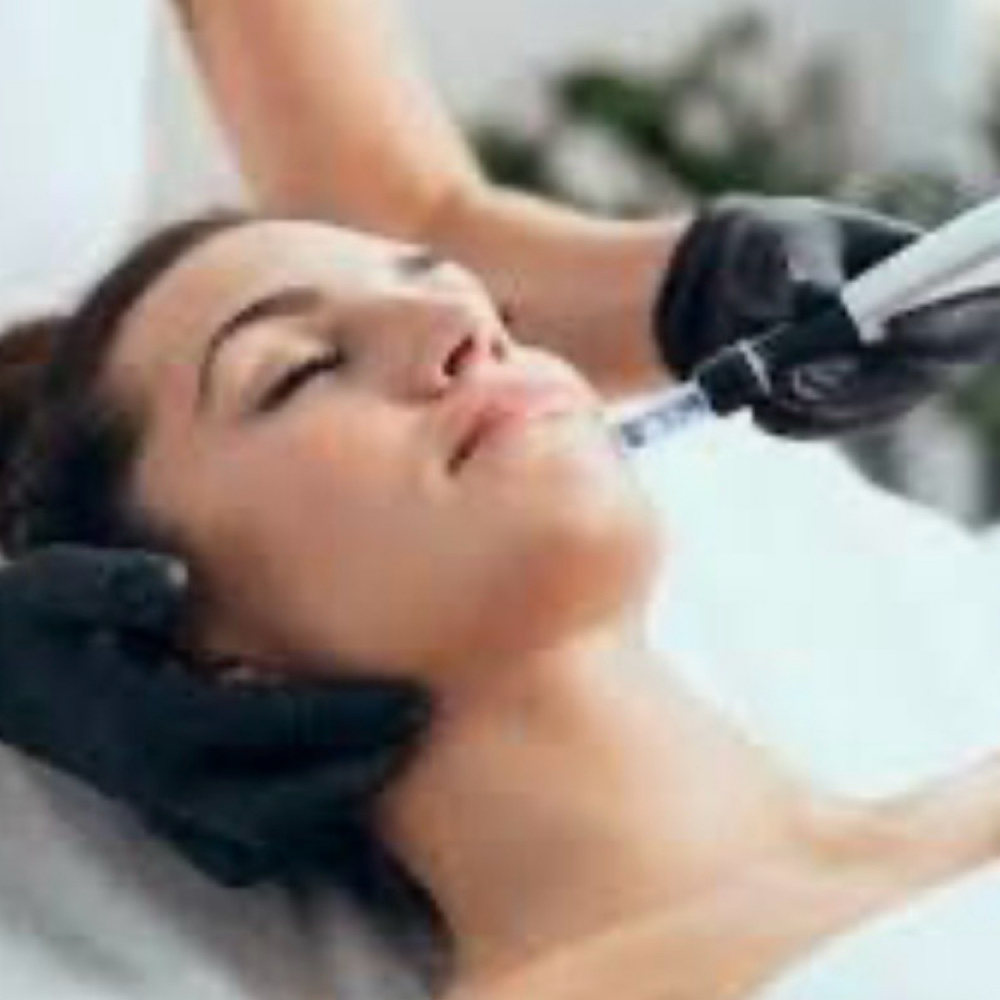 Microneedling Skin Renewal at Coastal Beauty Spa in Riverview, FL