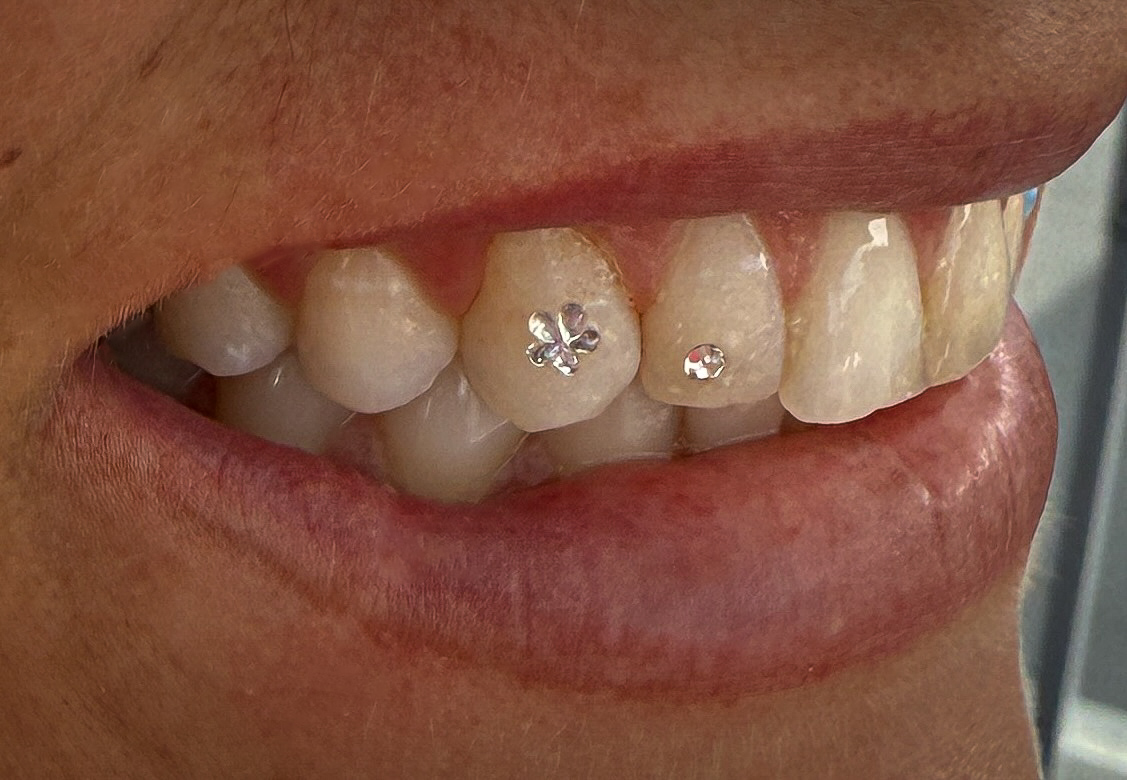 Tooth Gems at Ink & Arch in San Diego, CA