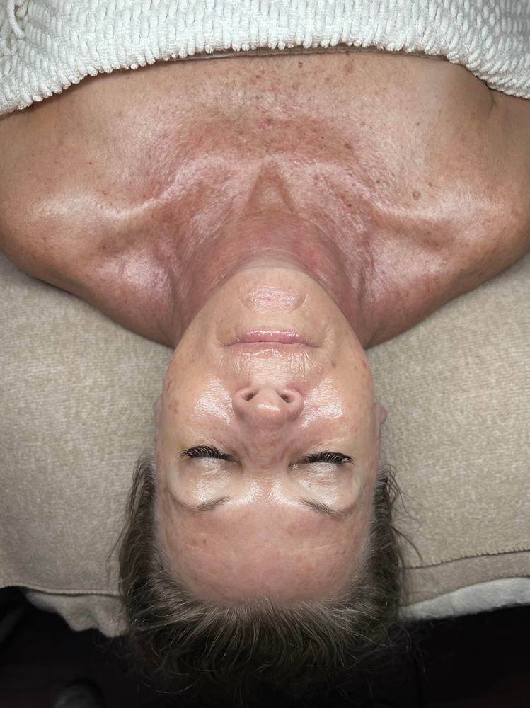 Basic Facial