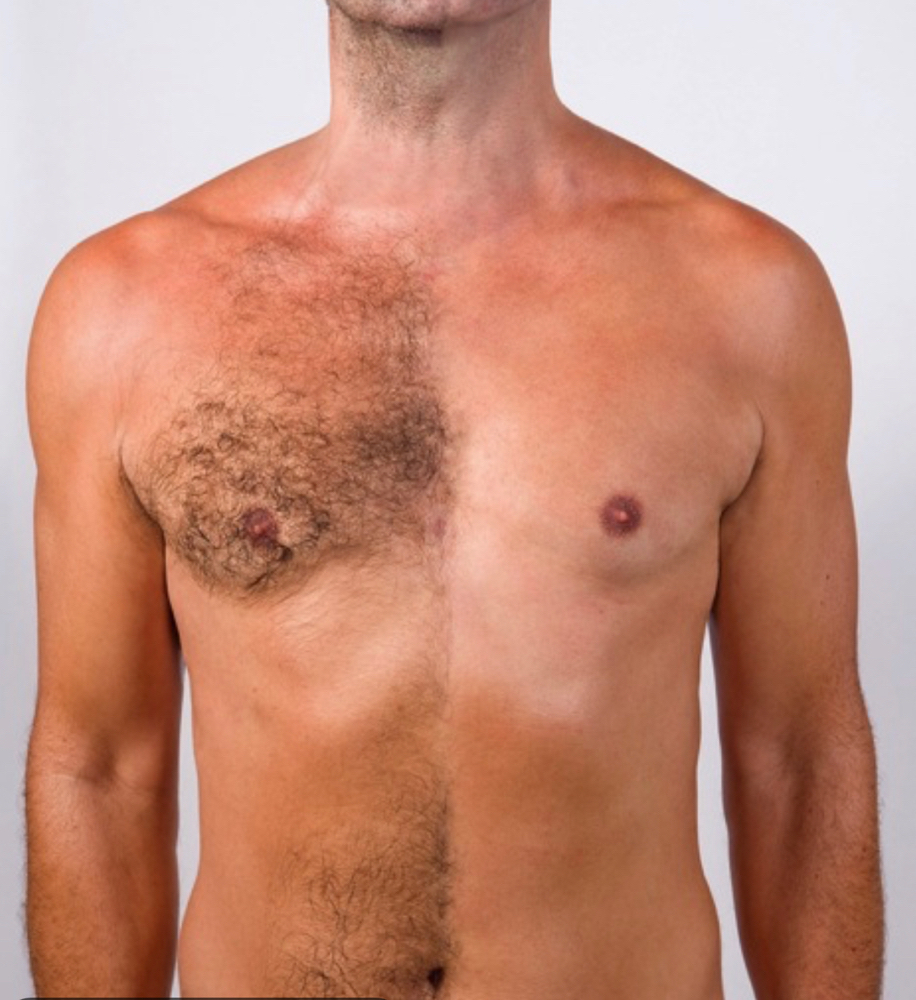 Chest Wax