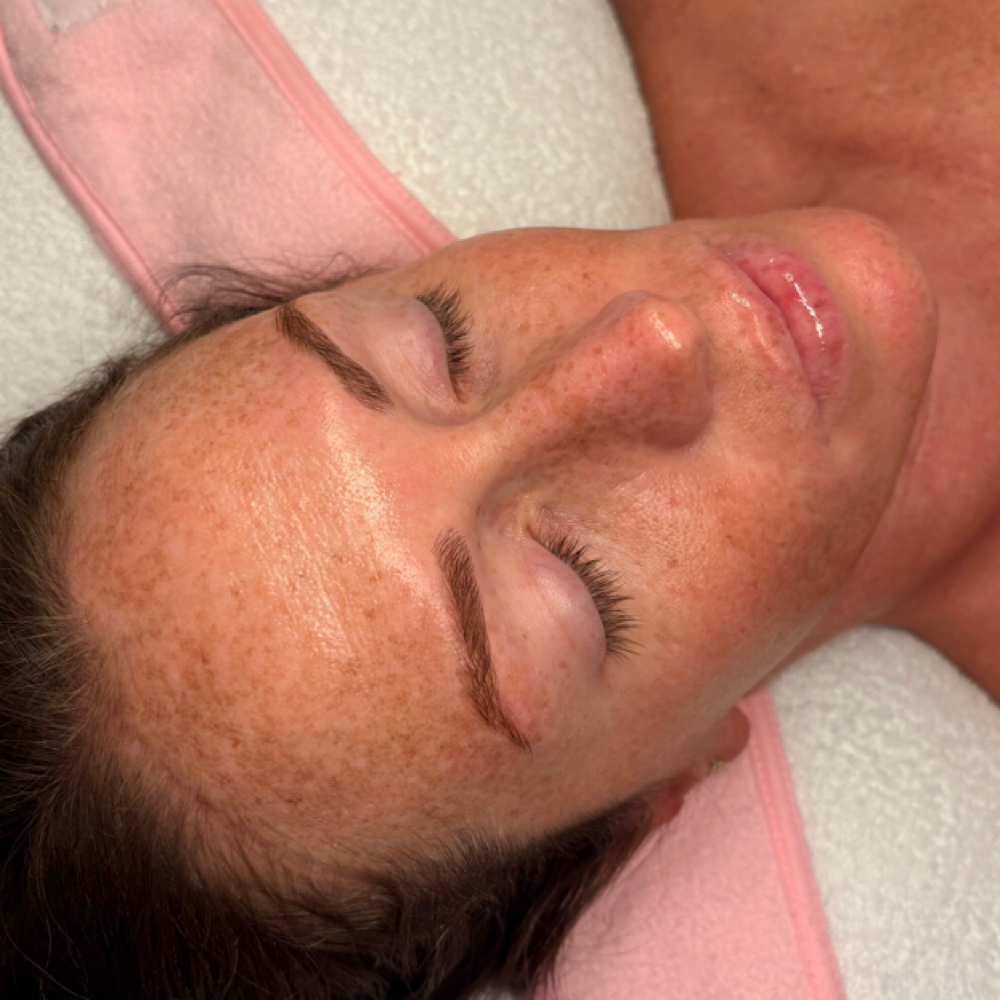 The Basic Glow Facial at KH Esthetics in Texarkana, TX