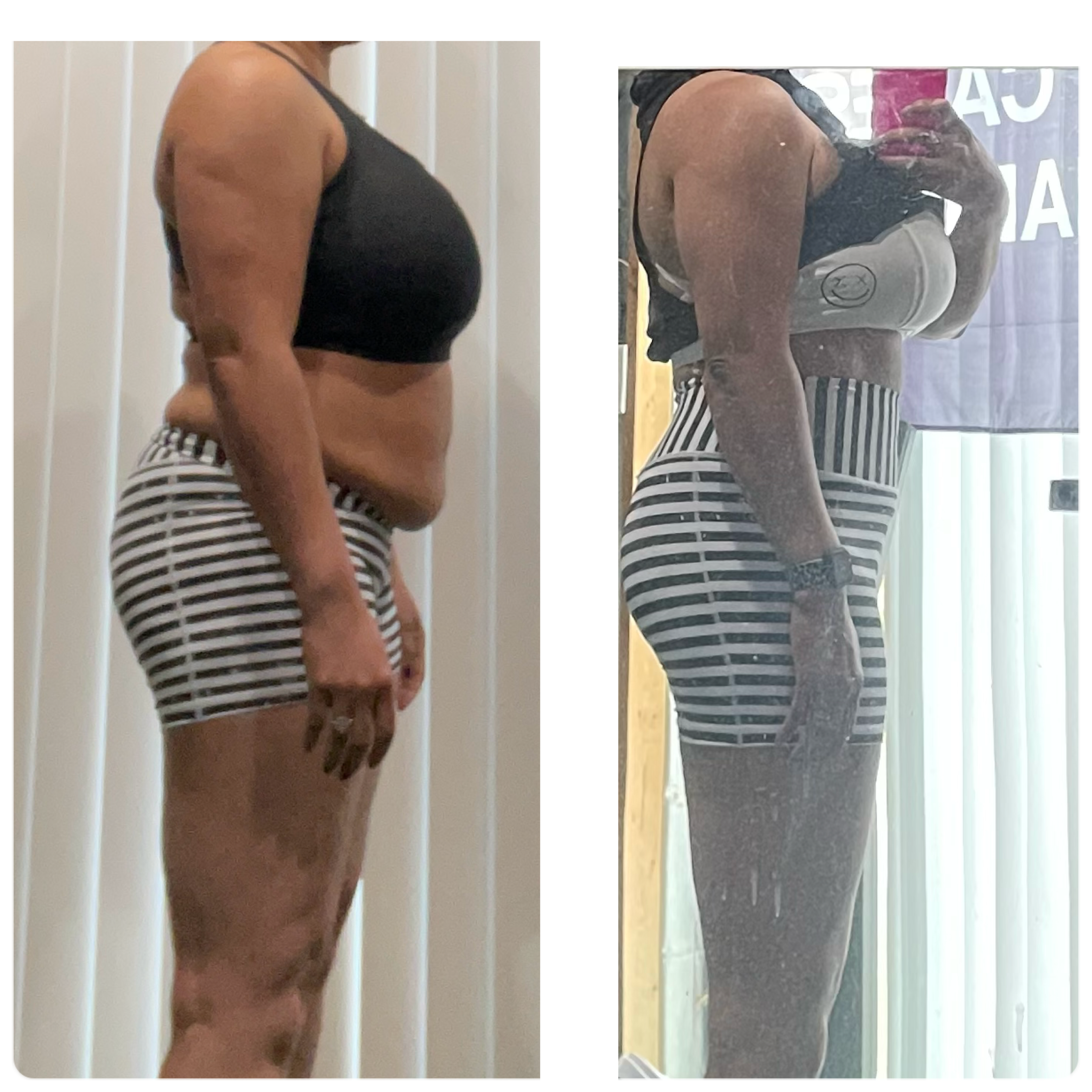 Weightloss Medications