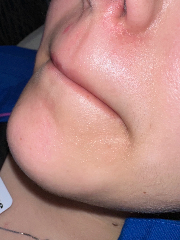Upper Lip Wax