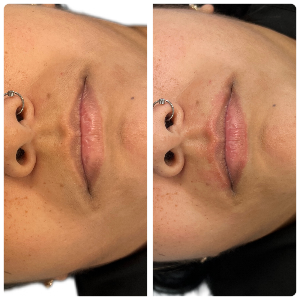 Upper Lip Wax