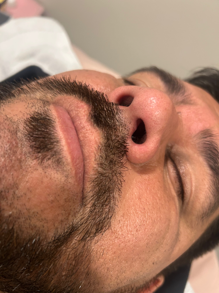 Nose And Ear Wax