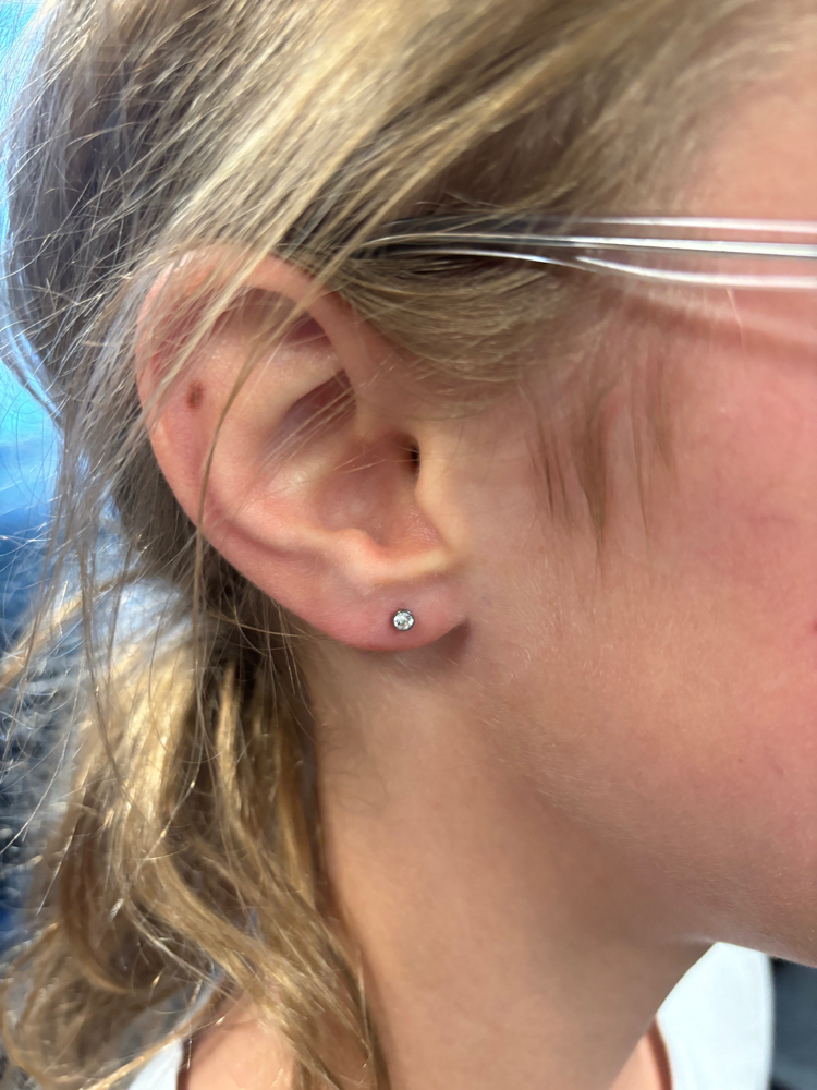 Double Lobe Service