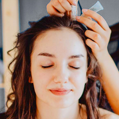 38- Microneedling Scalp/Hair
