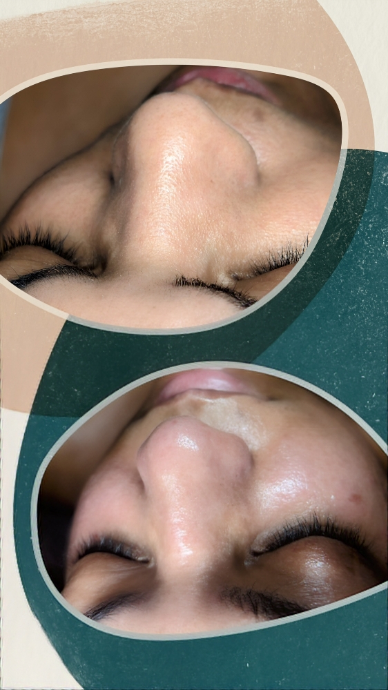 Facial 40 min 40min Massage