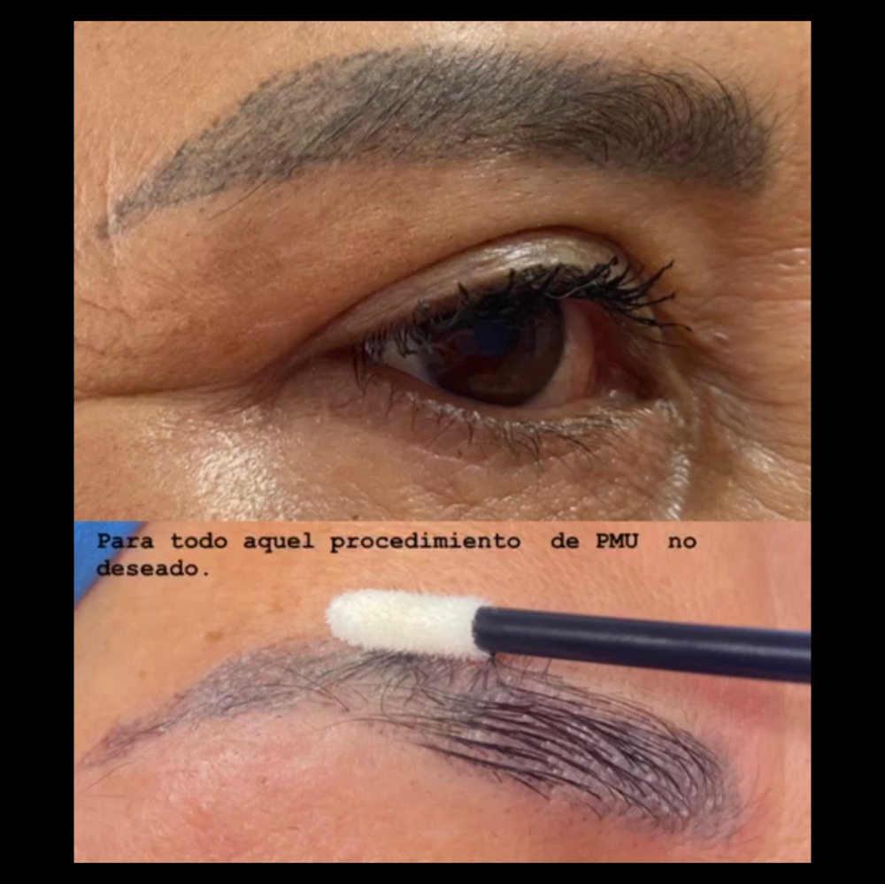 PMU Chemical Removal