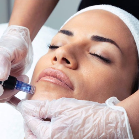 Sun Goddess Infusion - June Promo at Lotus Divine Beauty & Wellness in Tracy, CA