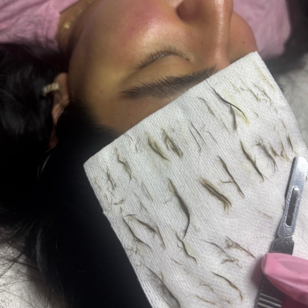 Dermaplane Facial at Live Lovely Esthetics in Richardson, TX