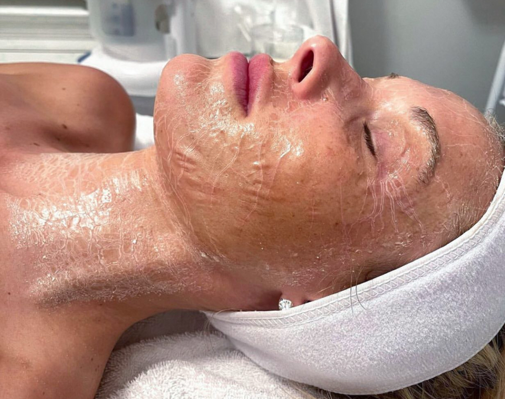 “Botox” Facial-Firming Treatment