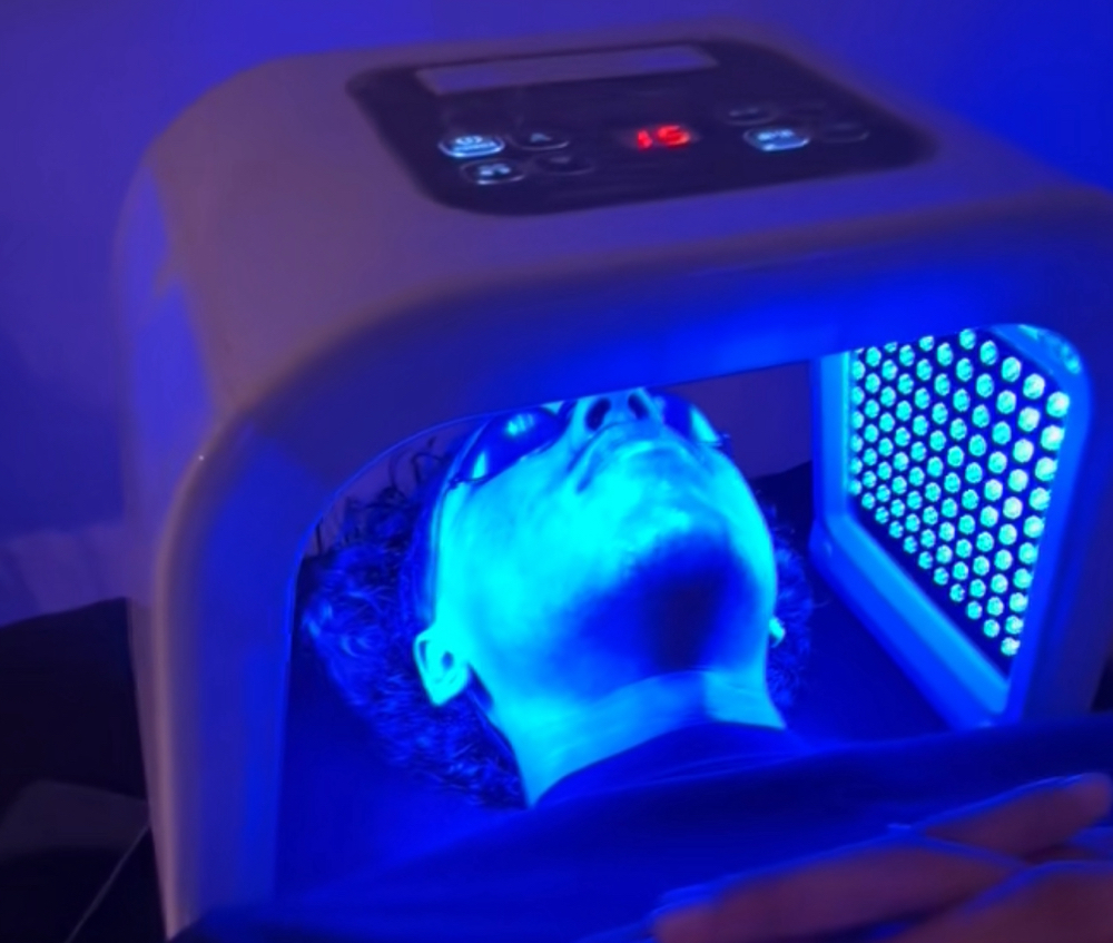 Acne Facial W/ LED light Treatment