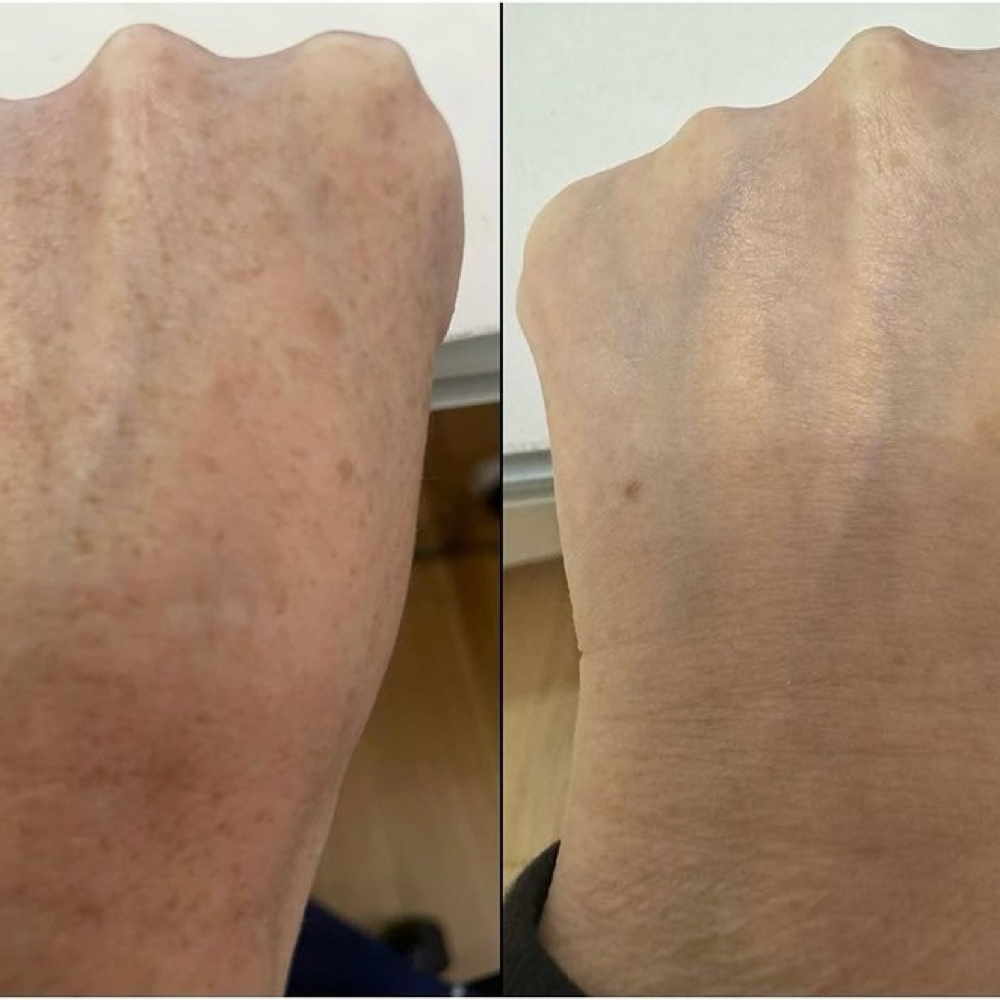 LUMECCA HANDS at Lavana by Remake in Edinburg, TX