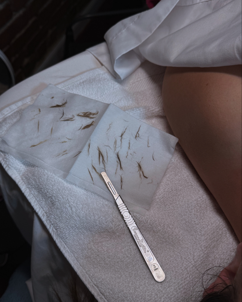 Dermaplane Facial