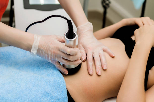 Fat Cavitation & RF Skin Tightening