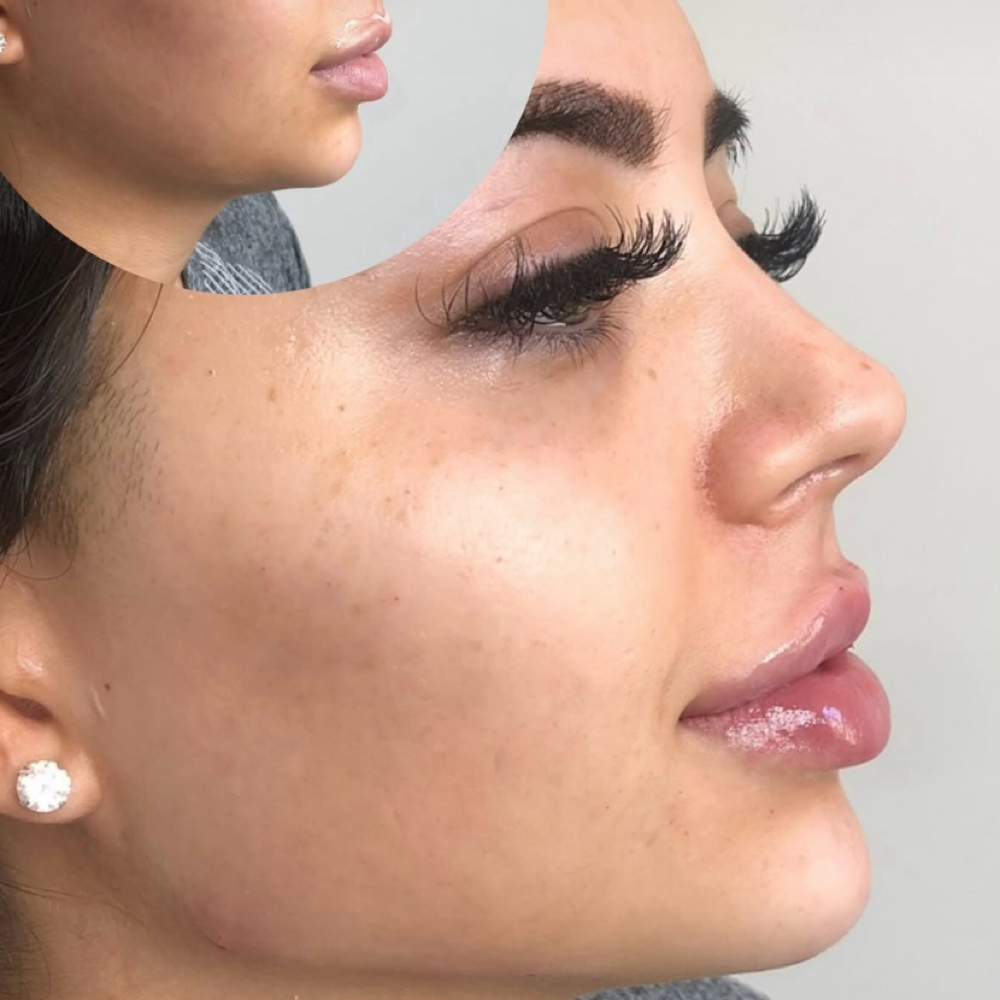 Online Zoom Consultation at Aesthetics by Amina in New York, NY