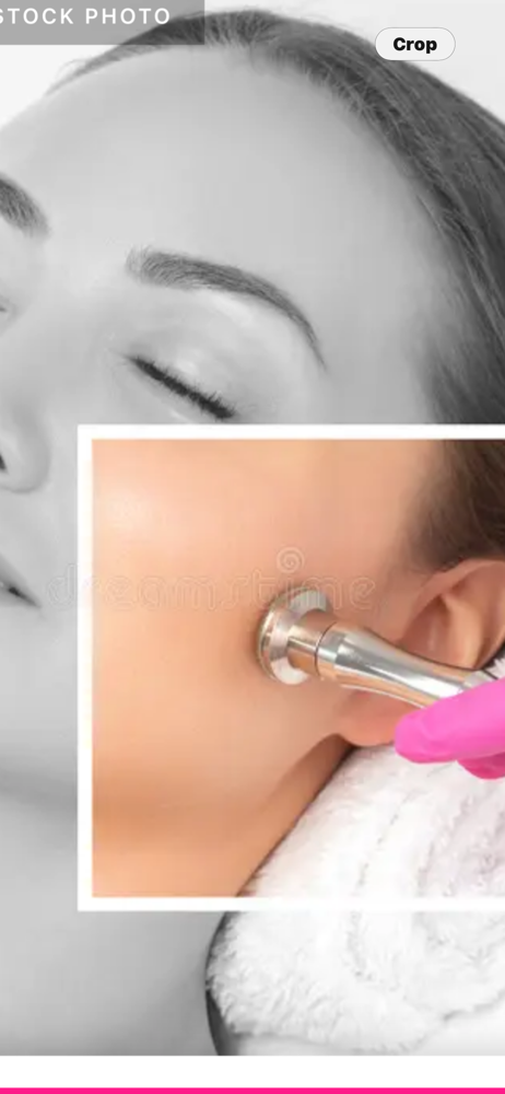 Microdermabrasion