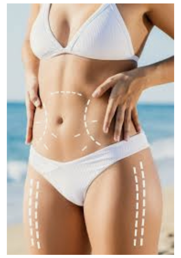 Reduccion Abdomen Con Aparatologia