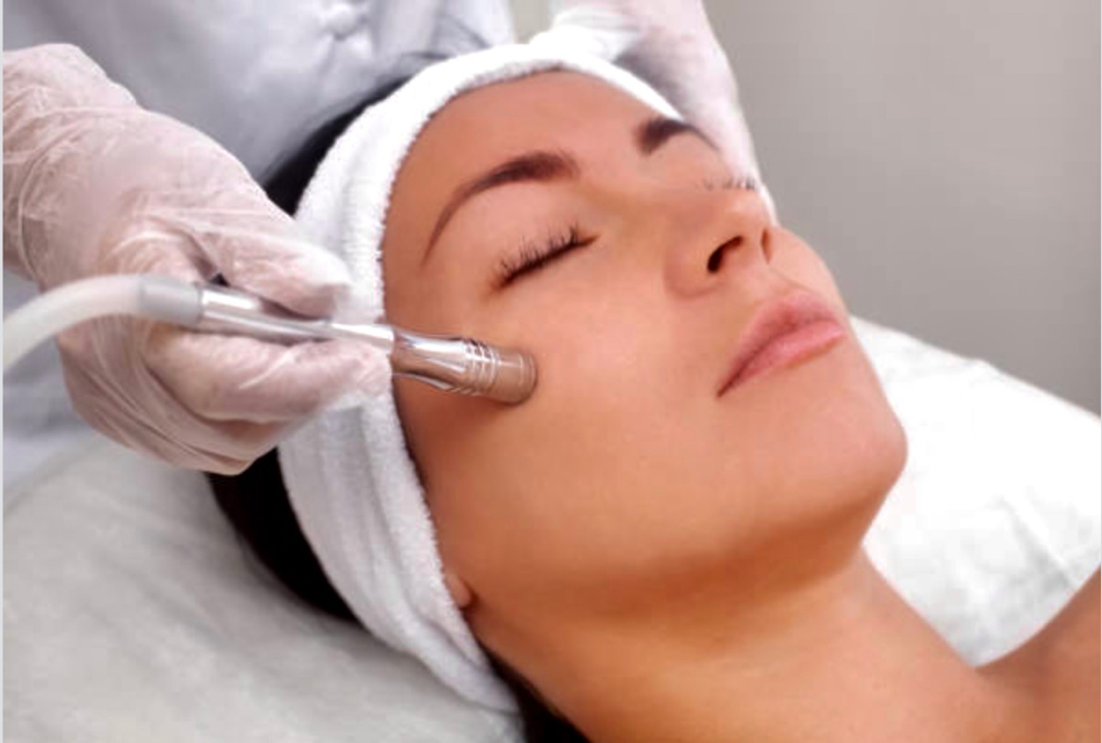 MICRODERMABRASION ADD-ON TREATMENT