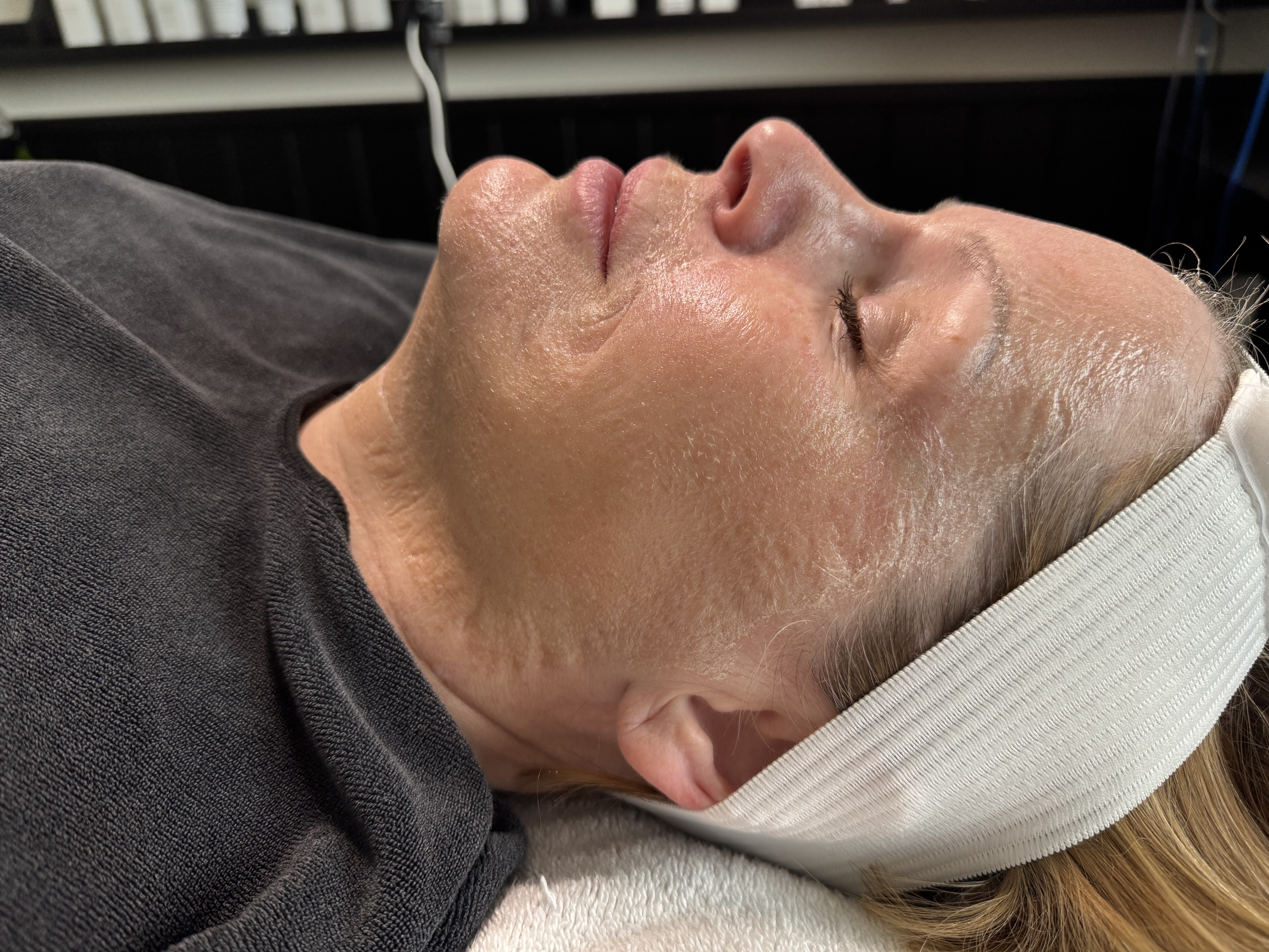 Firming Peptide Facial at Onyx Esthetics in Salem, OR
