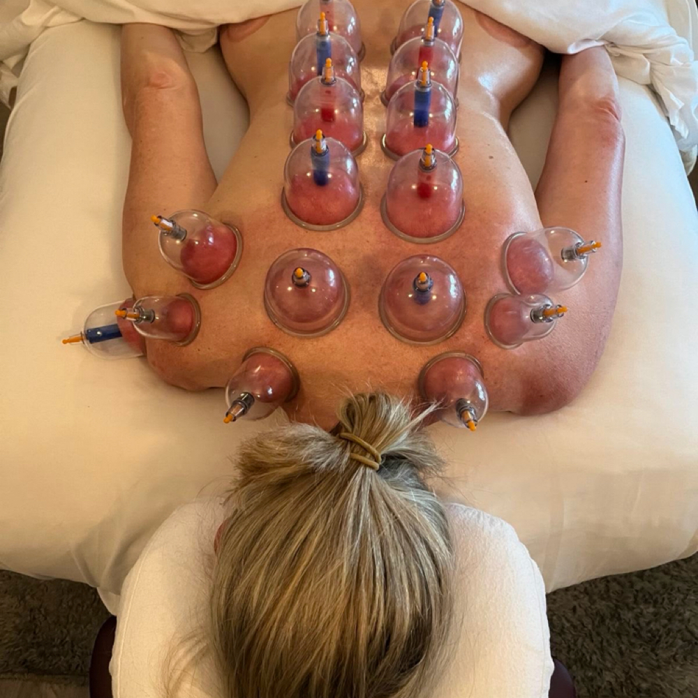 Dynamic Sports Cupping at Mountain Meadow Massage in Havre, MT