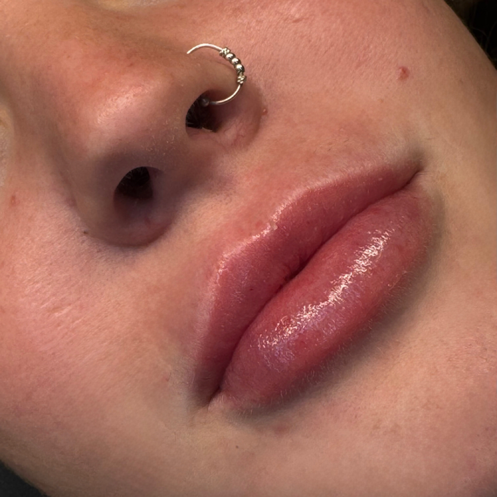 Hyaluron Lip Infusion 2ML at Bibbidi Bobbidi Brows in Louisville, KY