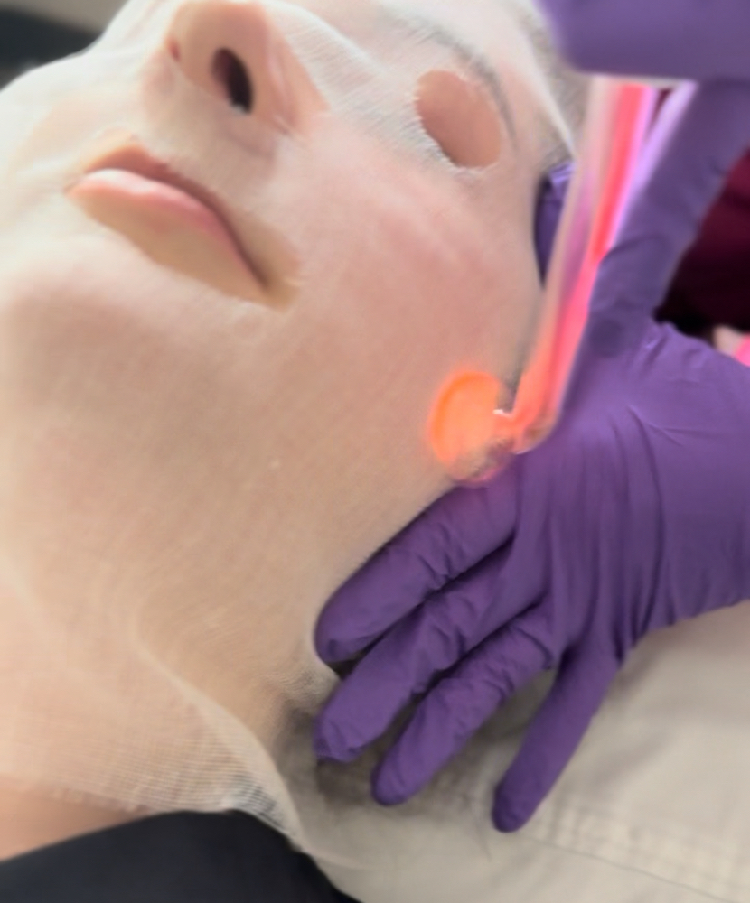 High Frequency Add-On